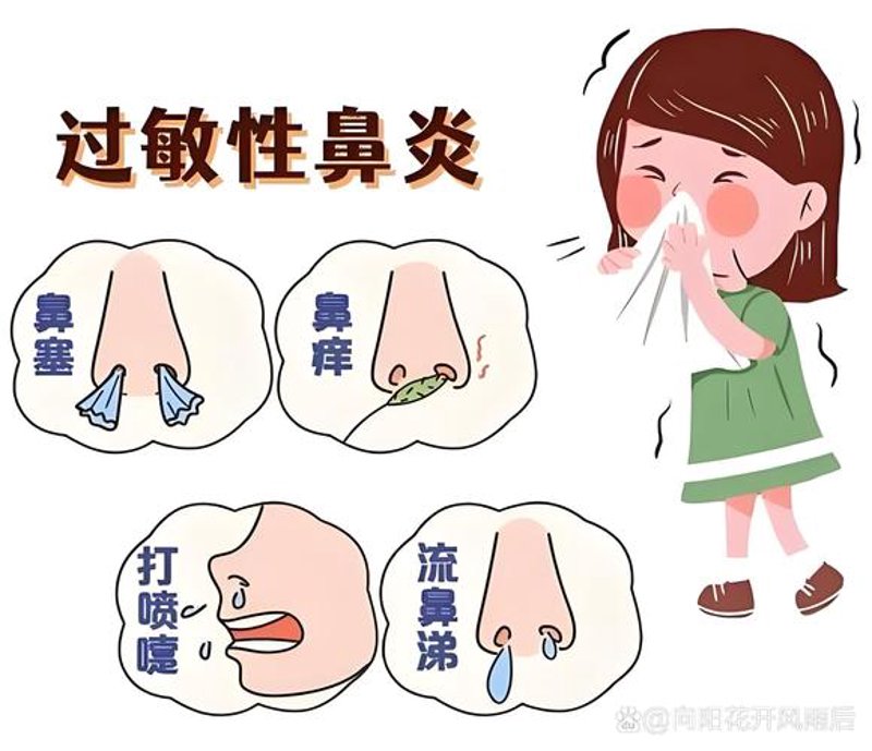 北京鼻炎高发季:如何有效缓解