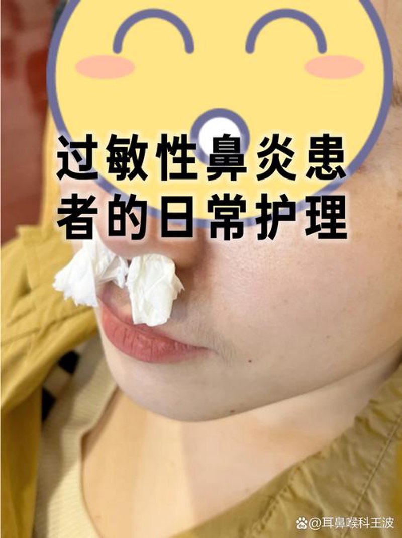 鼻炎护理小贴士:守护你呼吸顺畅的健康之道